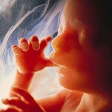 Fetus Fetus