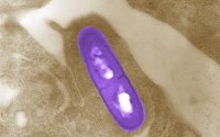 FDA wants food companies to hand over their pathogens