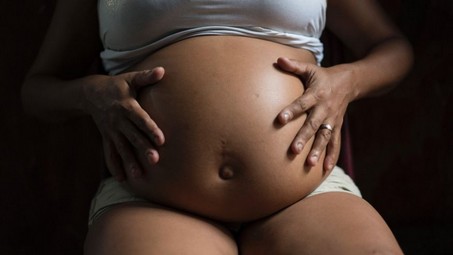 Zikapregnantwomen